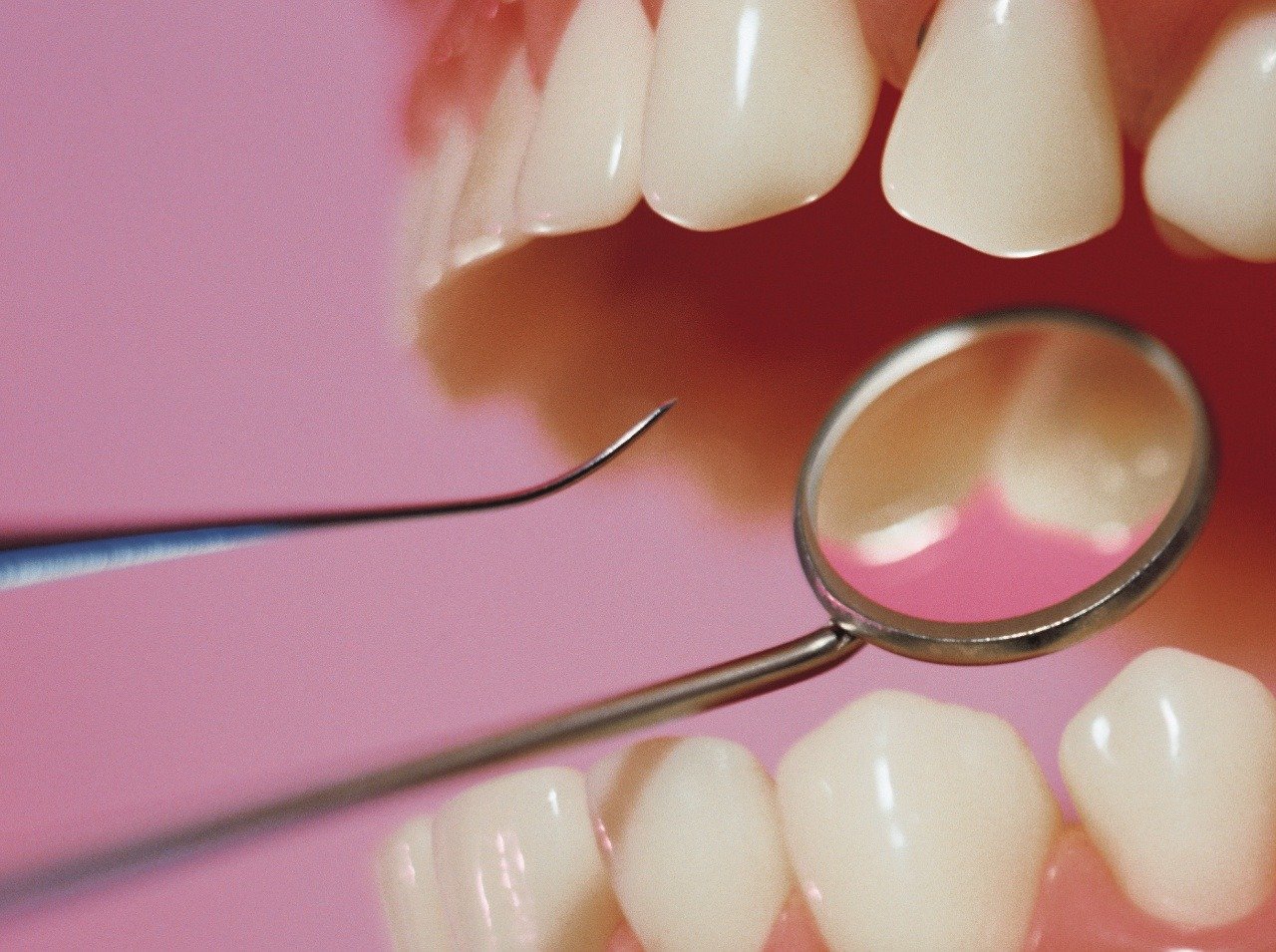 Bolesti zubov sú veľmi nepríjemné, nepodceňujte návštevu zubára. 