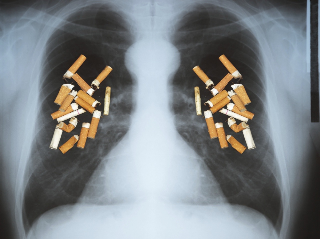 Fajčenie je mimoriadne nebezpečné a zvyšujete si tým riziko vzniku rakoviny pľúc.
