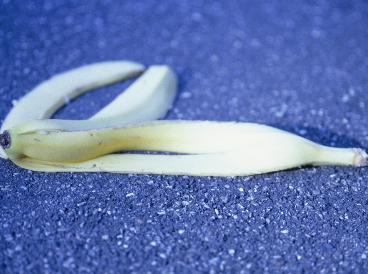 Nezabúdajte na banánovú šupku, ktorá obsahuje množstvo zdraviu prospešných látok. 