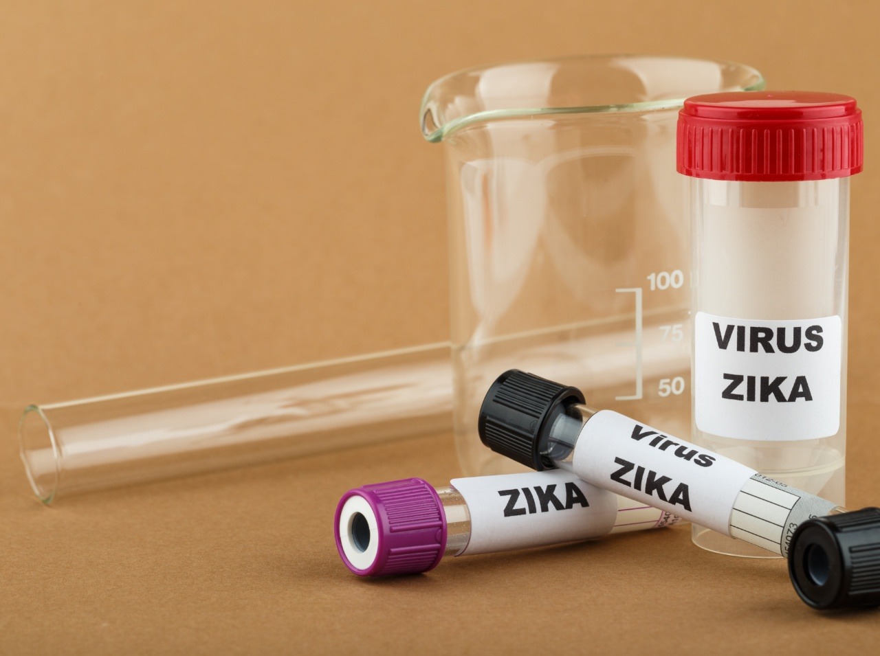 Vírus zika sa pomaly šíri po celom svete. 