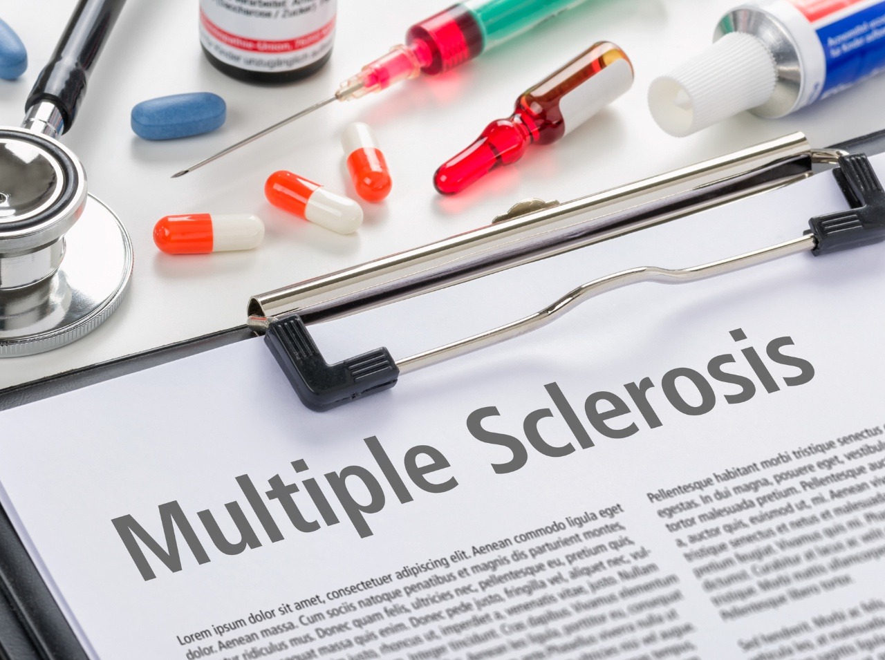 Skleróza multiplex je chronické ochorenie, ktoré najčastejšie zasahuje do života mladých. 
