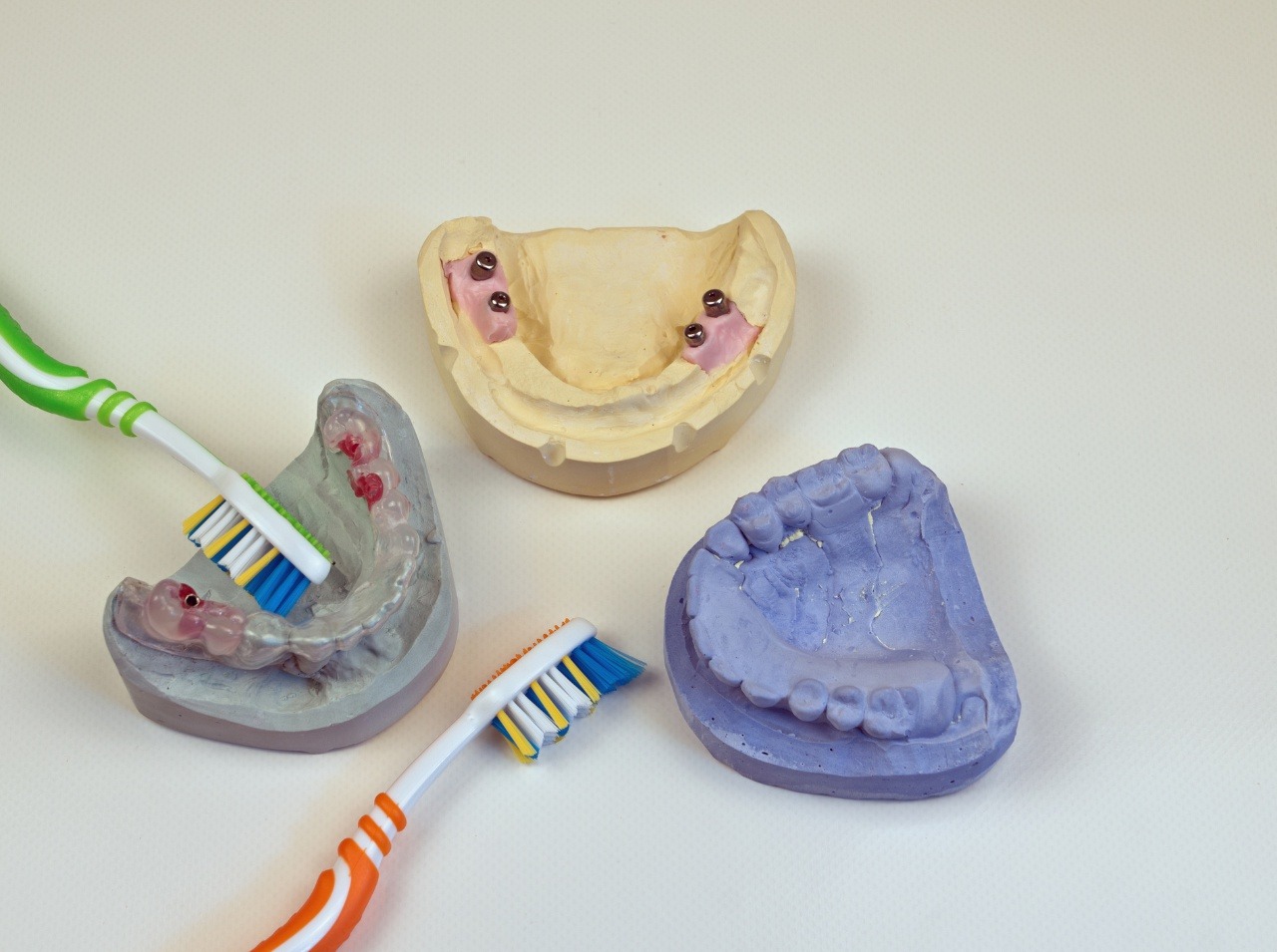 Ako sa prejavuje parodontitída? 