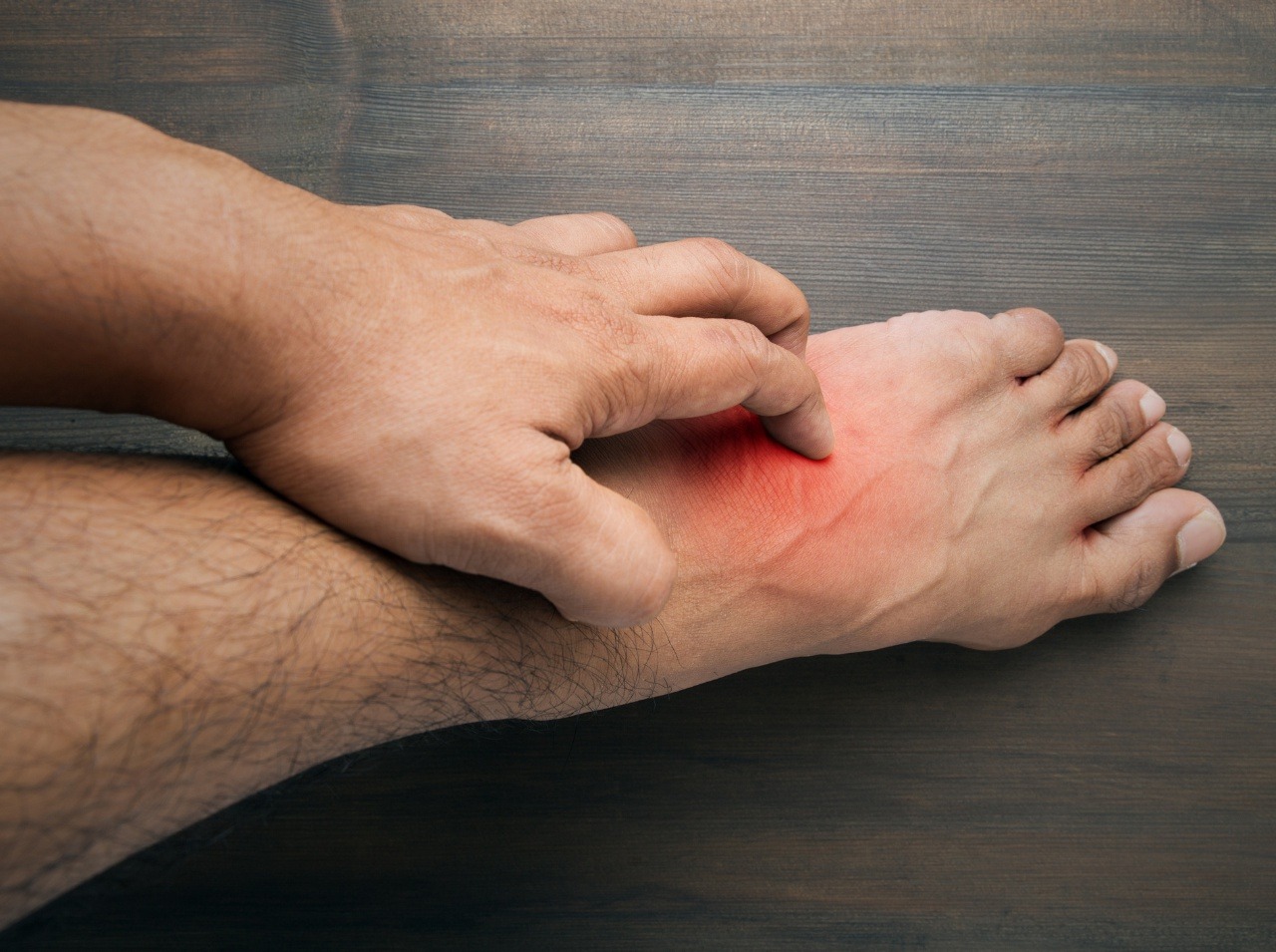 Nevysvetliteľné bolesti rúk a nôh, ktoré sú častejšie u mužov. Aj tak sa prejavuje Fabryho choroba. 