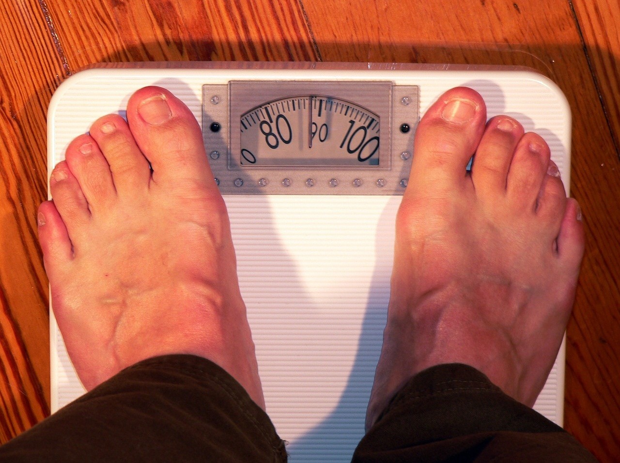 Aké sú možnosti liečby obezity a čo pre svoje zdravie vieme spraviť my sami? 