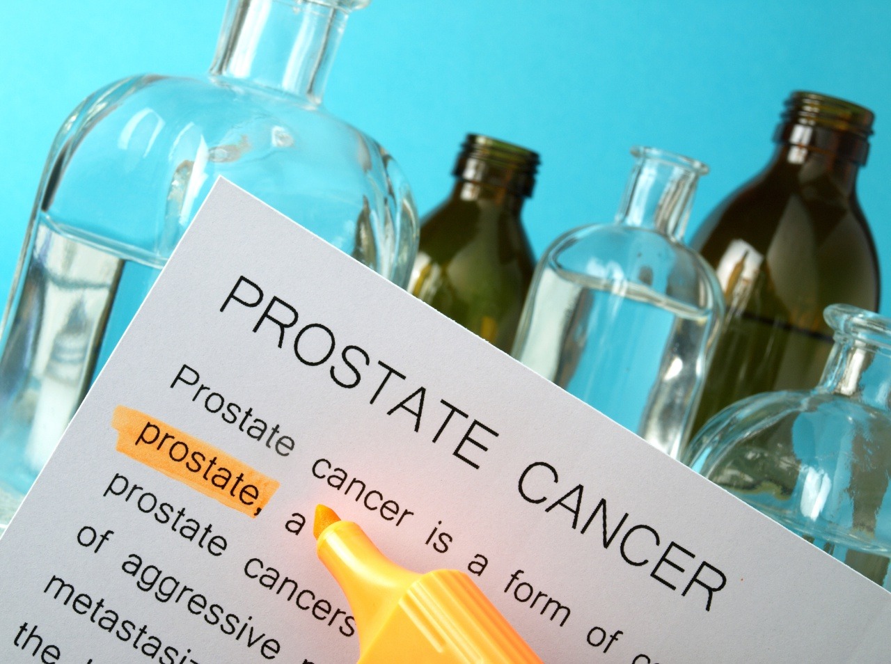 Diagnostika je pri mnohých ochoreniach kľúčová. Inak tomu nie je ani pri rakovine prostaty. 