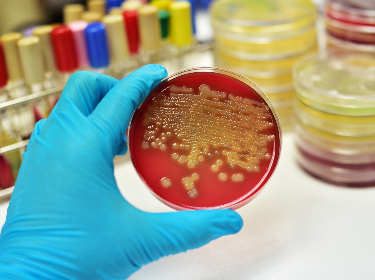 Niektoré baktérie sú nebezpečné a spôsobujú vážnu infekciu krvi. 