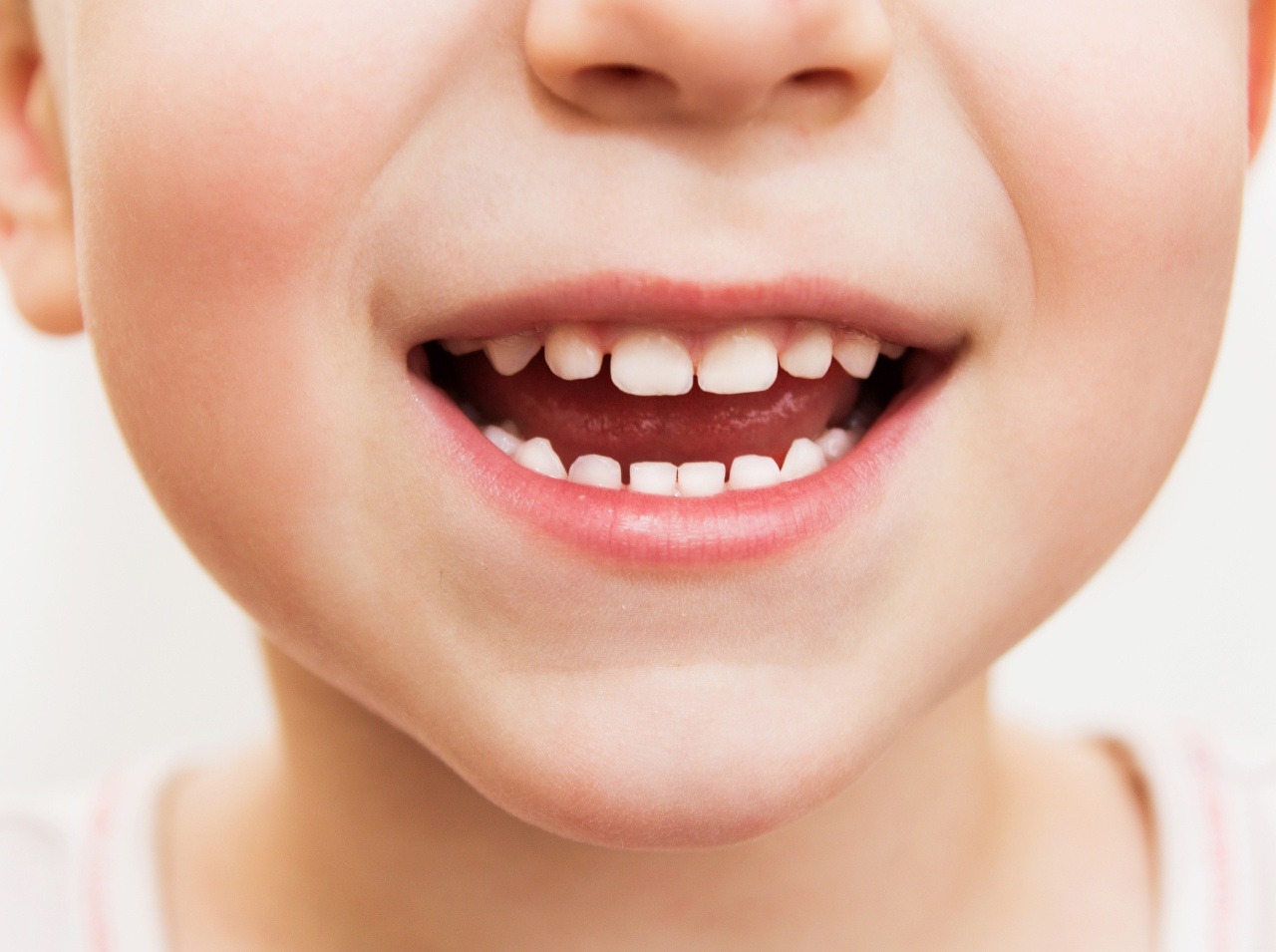 Najčastejším chronickým ochorením detí a mládeže je zubný kaz.