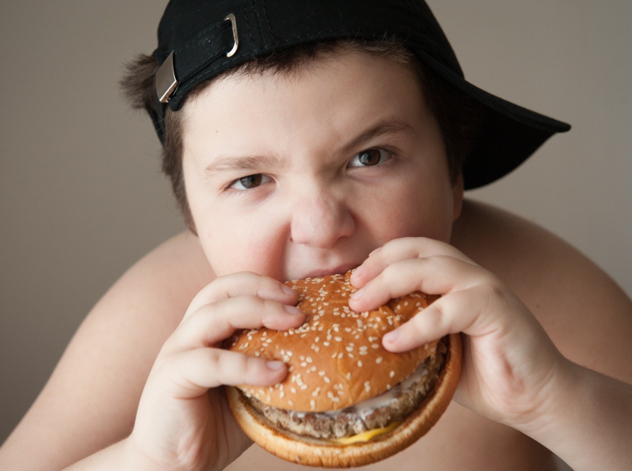 Podľa expertov je obéznych detí čoraz viac! 