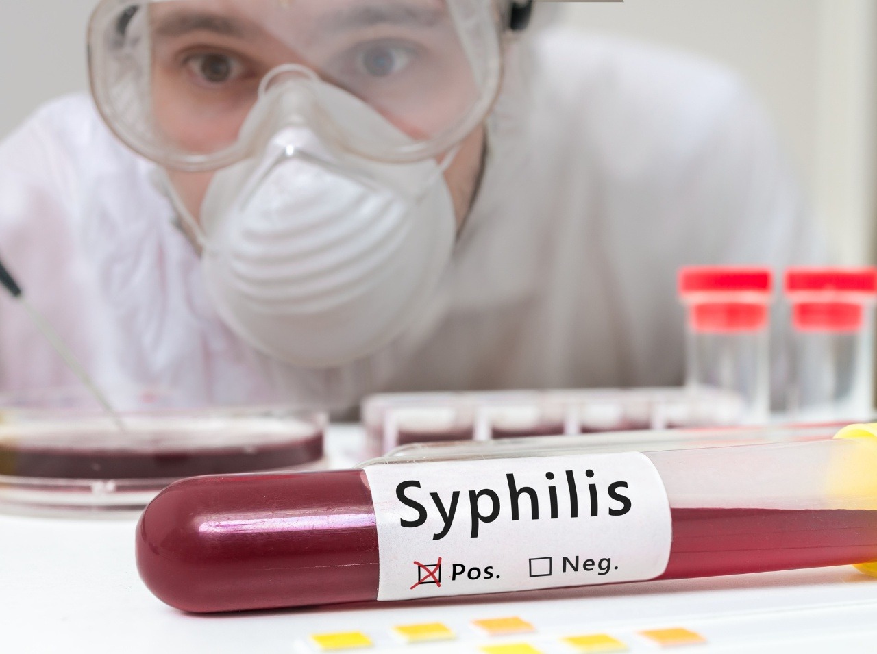 V roku 2016 bolo v Slovenskej republike hlásených 362 prípadov syfilisu (238 mužov a 124 žien).