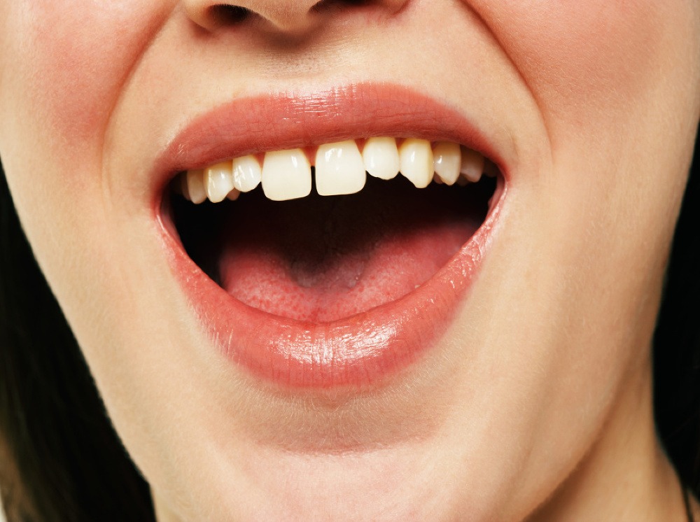 Baktérie v ústach môžu spôsobiť ochorenie čriev!