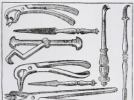Zubárske nástroje v 17. storočí.