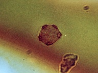 Cysta akantaméb ofarbená protargolom. Cysty sú veľmi odolné štádiá, parazit prechádza do štádia cysty pri nepriaznivých podmienkach (nedostatok potravy, UV žiarenie, teplota, dezinfekčné prostriedky). Foto: M. Mrva