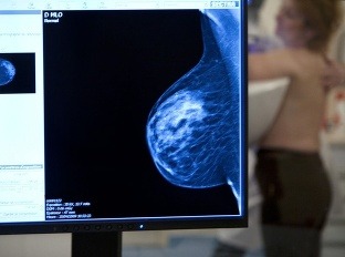 Mamografické vyšetrenie niektorí považujú