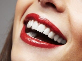 Krásne zuby bez kazov