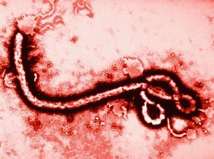 Ebola virus.