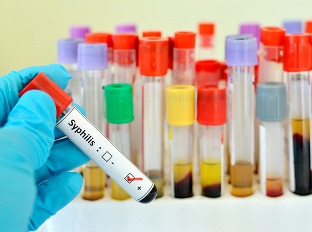 Syfilis vlani diagnostikovali bábätku