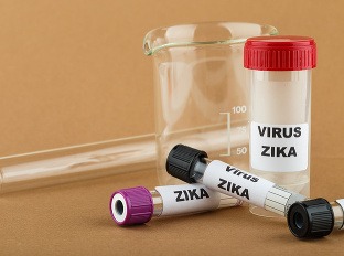 Vírus zika sa pomaly