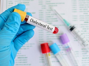 Nepodceňujte cholesterol, môže vyvolať