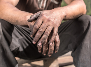 Špinavé ruky priťahujú infekcie:
