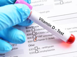 Slovami odborníka: Nedostatok vitamínu