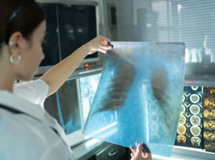 NCZI: Počet prípadov tuberkulózy