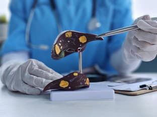 Hepatológ: Zdravie pečene úzko