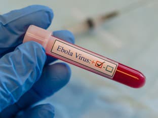 Ebola: Ako sa šíri,