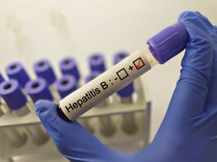 Prelom v liečbe hepatitídy