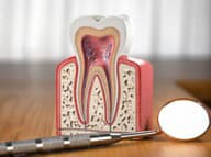 Tooth model cross section with dental mirror tool on wooden table. Close up. Dental treatment and hygiene concept. 3d illustration