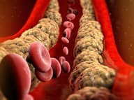 Trápi vás vysoký cholesterol a bolesti kĺbov? TENTO domáci sirup to zmení
