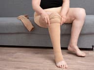 O trombóze nemusíte vôbec tušiť, prekvapiť vás môže nečakane!