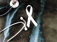 Toto je 10 spôsobov, ako môžete ZNÍŽIŤ riziko rakoviny