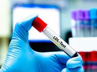 Prečo sa cholesterol zhoršuje aj u ľudí, ktorí nejedia veľa tuku