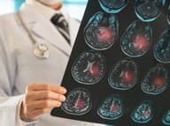 Tri malé denné zmeny môžu výrazne znížiť riziko infarktu aj mozgovej príhody