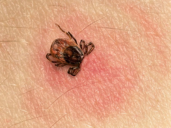 V Košiciach hospitalizovali niekoľko ľudí s podozrením na závažnú chorobu. Čo im hrozí? 