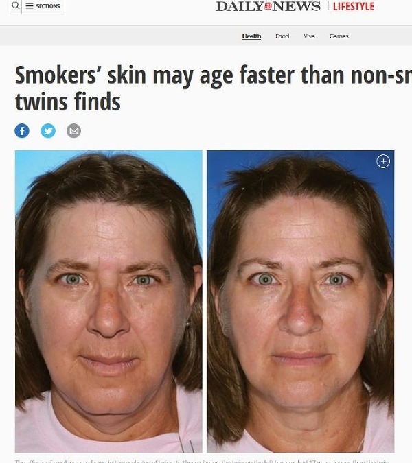 Na tento fotografii je žena vľavo fajčiarkou. Prezradili ju mierne sfarbené, vrásčité pery, než má jej sestra. Vzhľadom na to, že pery prichádzajú do najbližšieho kontaktu s cigaretovým dymom, je zjavné, že sa to na nich odrazí. (Foto: screenshot nydailynews.com)