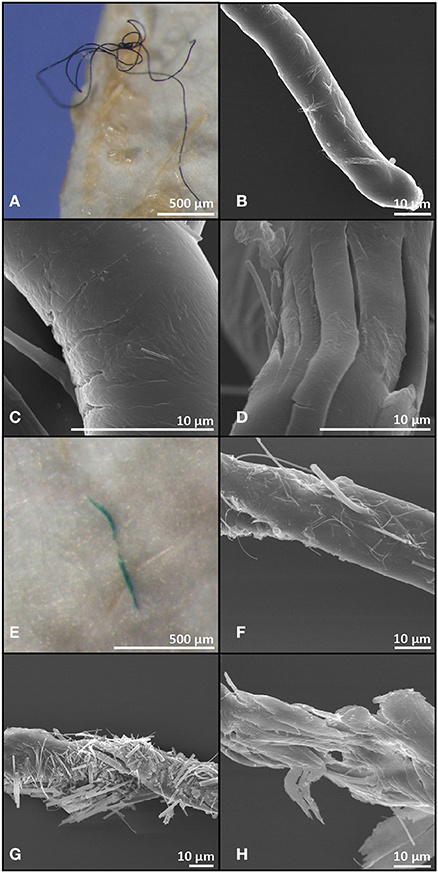 Plastové vlákna z tiel rýb pod mikroskopom. Foto: Frontiers in Marine Science