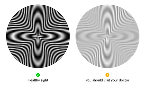Ak vidíte čiary rovnako ako na prvom obrázku vľavo, máte zdravé oči. Odborníka treba vyhľadať, ak vidíte niečo podobné, ako na druhom obrázku. 