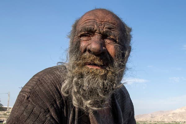 Amou Haji, známy ako najšpinavší muž sveta, sa celé desaťročia nesprchoval.